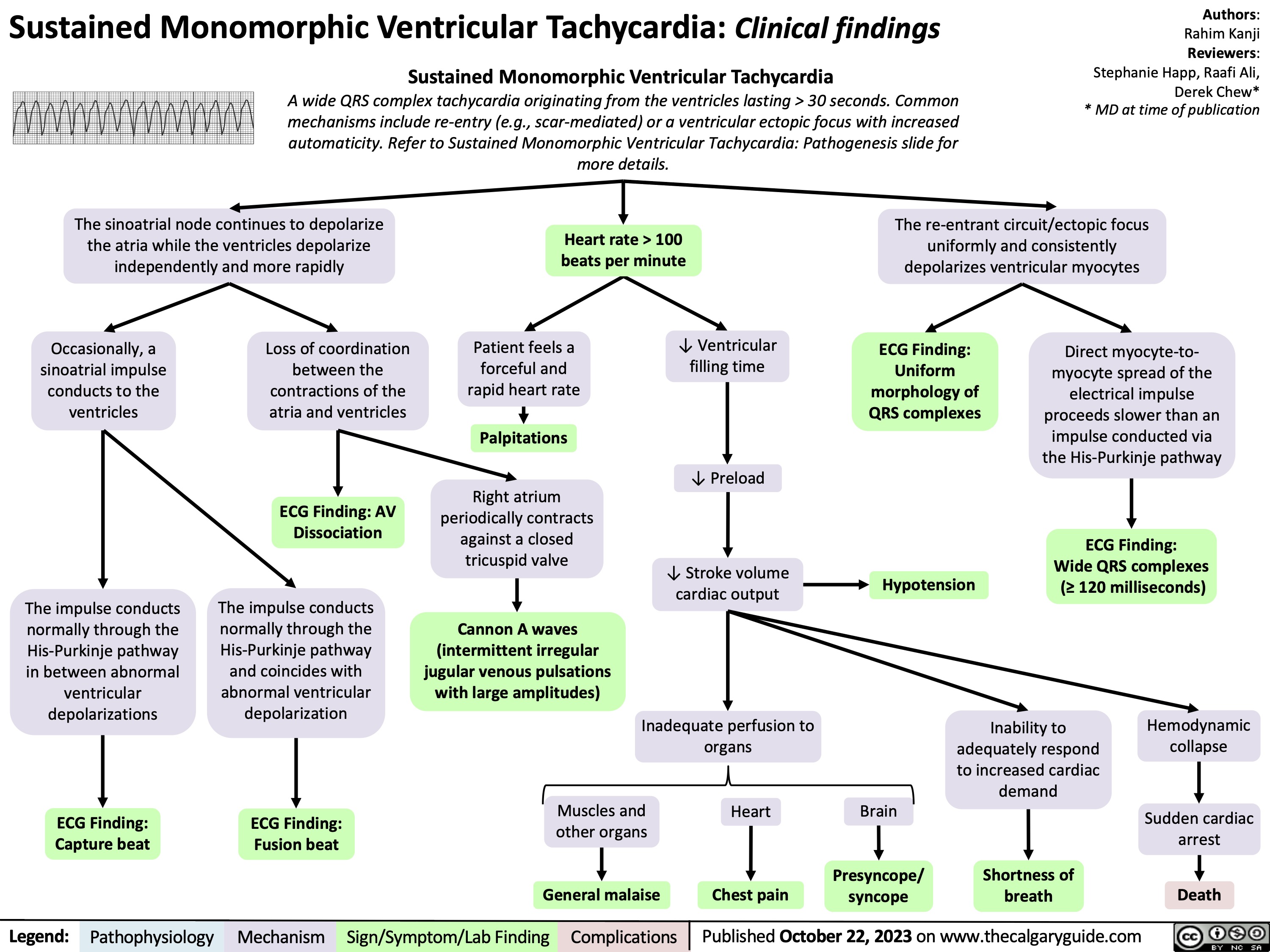 Sustained Monomorphic Ventricular Tachycardia: Clinical findings
Sustained Monomorphic Ventricular Tachycardia
A wide QRS complex tachycardia originating from the ventricles lasting > 30 seconds. Common mechanisms include re-entry (e.g., scar-mediated) or a ventricular ectopic focus with increased automaticity. Refer to Sustained Monomorphic Ventricular Tachycardia: Pathogenesis slide for more details.
Authors: Rahim Kanji Reviewers: Stephanie Happ, Raafi Ali, Derek Chew* * MD at time of publication
     The sinoatrial node continues to depolarize the atria while the ventricles depolarize independently and more rapidly
Heart rate > 100 beats per minute
The re-entrant circuit/ectopic focus uniformly and consistently depolarizes ventricular myocytes
           Occasionally, a sinoatrial impulse conducts to the ventricles
Loss of coordination between the contractions of the atria and ventricles
ECG Finding: AV Dissociation
The impulse conducts normally through the His-Purkinje pathway and coincides with abnormal ventricular depolarization
ECG Finding: Fusion beat
Patient feels a forceful and rapid heart rate
Palpitations
Right atrium periodically contracts against a closed tricuspid valve
Cannon A waves (intermittent irregular jugular venous pulsations with large amplitudes)
↓ Ventricular filling time
↓ Preload
↓ Stroke volume cardiac output
Inadequate perfusion to organs
ECG Finding: Uniform morphology of QRS complexes
Direct myocyte-to- myocyte spread of the electrical impulse proceeds slower than an impulse conducted via the His-Purkinje pathway
ECG Finding: Wide QRS complexes (≥ 120 milliseconds)
             The impulse conducts normally through the His-Purkinje pathway in between abnormal ventricular depolarizations
ECG Finding: Capture beat
Muscles and other organs
General malaise
Heart
Chest pain
Brain
Presyncope/ syncope
Inability to adequately respond to increased cardiac demand
Shortness of breath
Hemodynamic collapse
Sudden cardiac arrest
Death
Hypotension
                         Legend:
 Pathophysiology
Mechanism
Sign/Symptom/Lab Finding
 Complications
 Published October 22, 2023 on www.thecalgaryguide.com
   