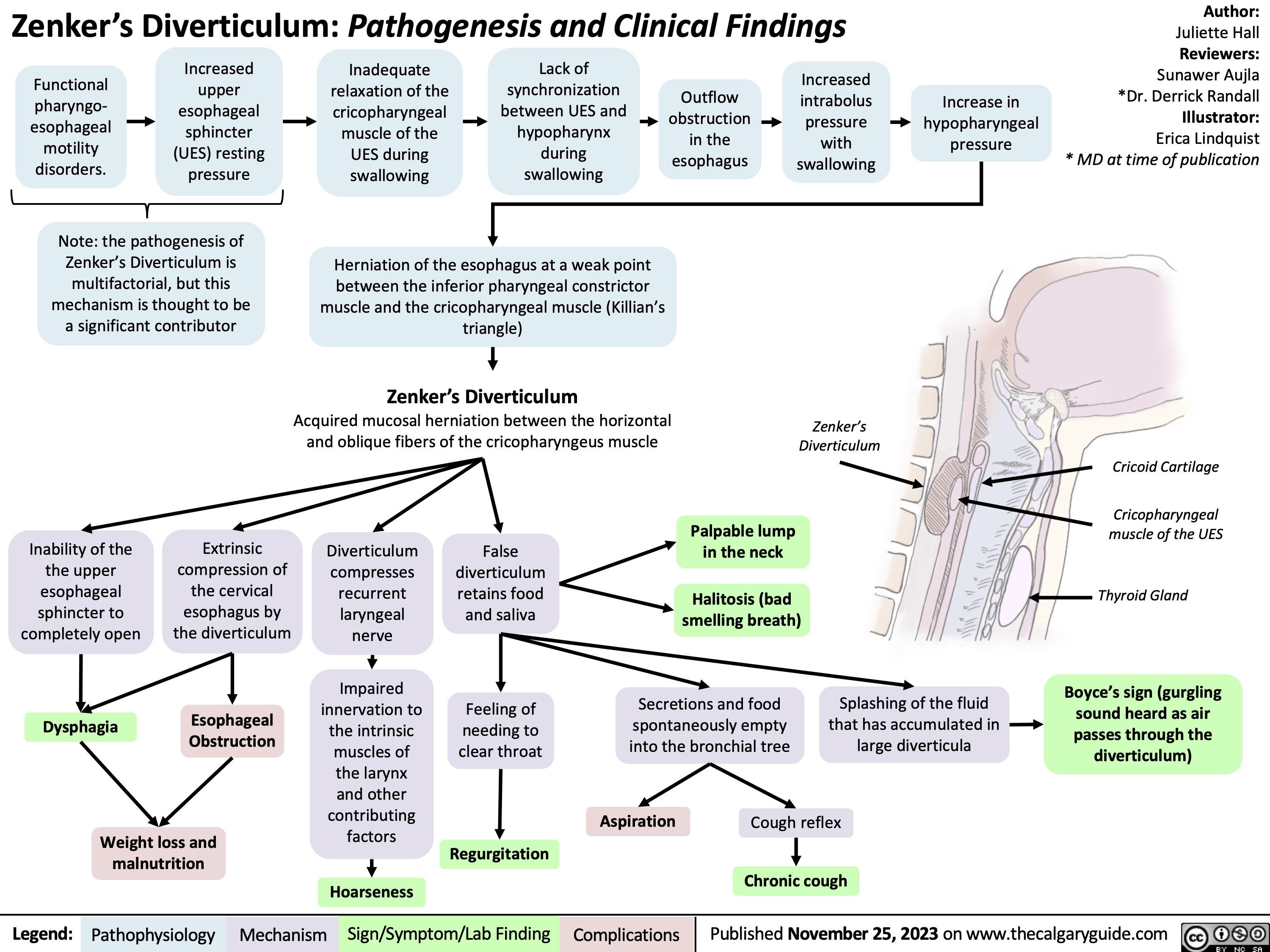 Zenker’s Diverticulum: Pathogenesis and Clinical Findings
Author:
Juliette Hall
Reviewers:
Sunawer Aujla *Dr. Derrick Randall Illustrator: Erica Lindquist * MD at time of publication
     Functional pharyngo- esophageal motility disorders.
Increased upper esophageal sphincter (UES) resting pressure
Inadequate relaxation of the cricopharyngeal muscle of the UES during swallowing
Lack of synchronization between UES and hypopharynx during swallowing
Outflow obstruction in the esophagus
Increased intrabolus pressure with swallowing
Increase in hypopharyngeal pressure
     Note: the pathogenesis of Zenker’s Diverticulum is multifactorial, but this mechanism is thought to be a significant contributor
Herniation of the esophagus at a weak point
between the inferior pharyngeal constrictor muscle and the cricopharyngeal muscle (Killian’s triangle)
Zenker’s Diverticulum
Acquired mucosal herniation between the horizontal and oblique fibers of the cricopharyngeus muscle
             Inability of the the upper esophageal sphincter to completely open
Dysphagia
Extrinsic compression of the cervical esophagus by the diverticulum
Esophageal Obstruction
Diverticulum compresses recurrent laryngeal nerve
Impaired
innervation to
the intrinsic
muscles of
the larynx
and other
contributing
factors
False diverticulum retains food and saliva
Feeling of needing to clear throat
Palpable lump in the neck
Halitosis (bad smelling breath)
Secretions and food spontaneously empty into the bronchial tree
Splashing of the fluid that has accumulated in large diverticula
Cricoid Cartilage
Cricopharyngeal muscle of the UES
Thyroid Gland
Boyce’s sign (gurgling sound heard as air passes through the diverticulum)
Zenker’s Diverticulum
                       Weight loss and malnutrition
Aspiration
Cough reflex
Chronic cough
 Regurgitation Hoarseness
   Legend:
 Pathophysiology
Mechanism
 Sign/Symptom/Lab Finding
 Complications
Published November 25, 2023 on www.thecalgaryguide.com
   