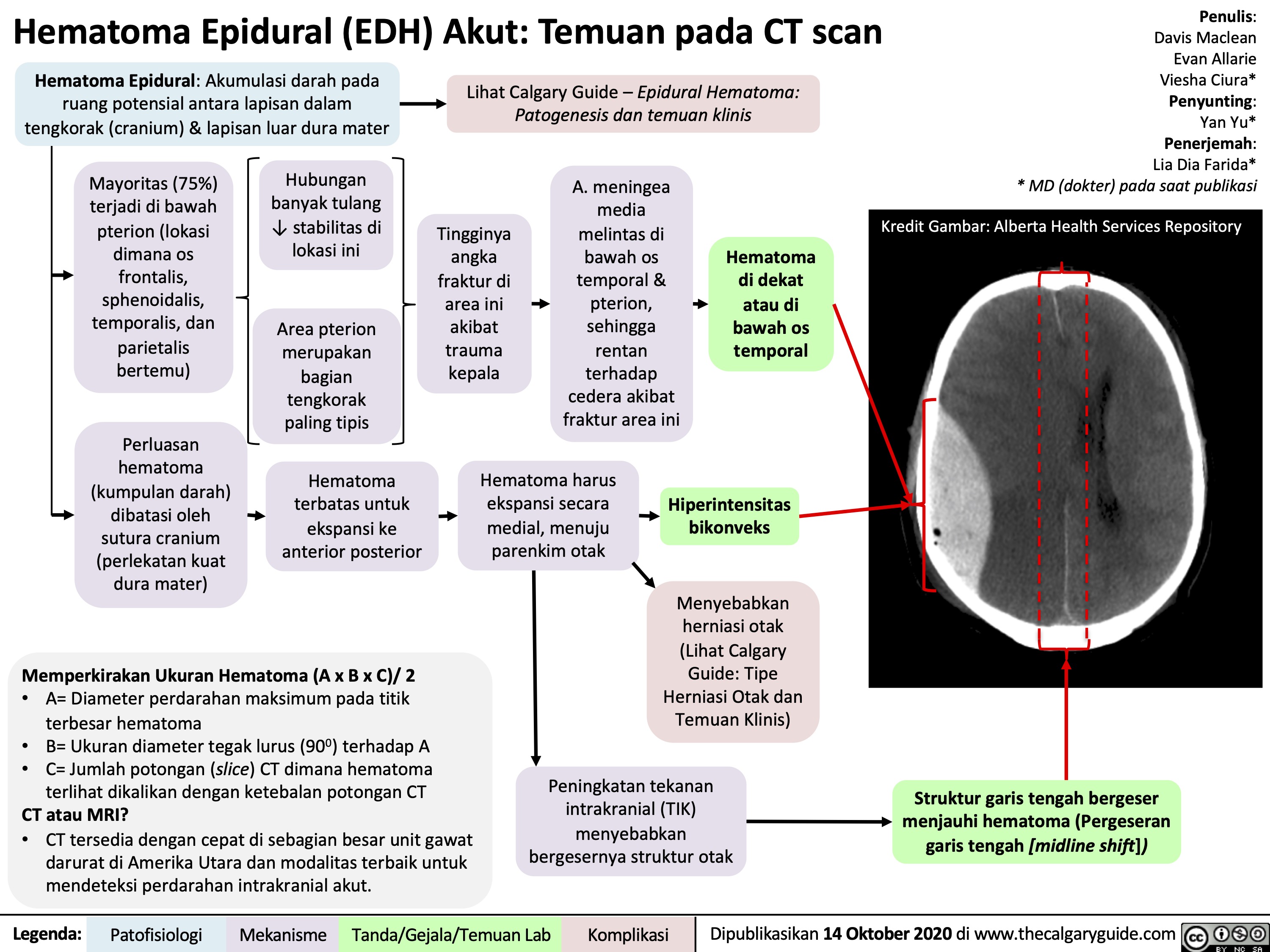 Hematoma Epidural (EDH) Akut: Temuan pada CT scan