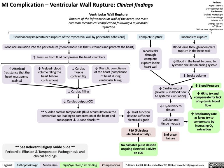 MI Complication: Ventricular Wall Rupture | Calgary Guide