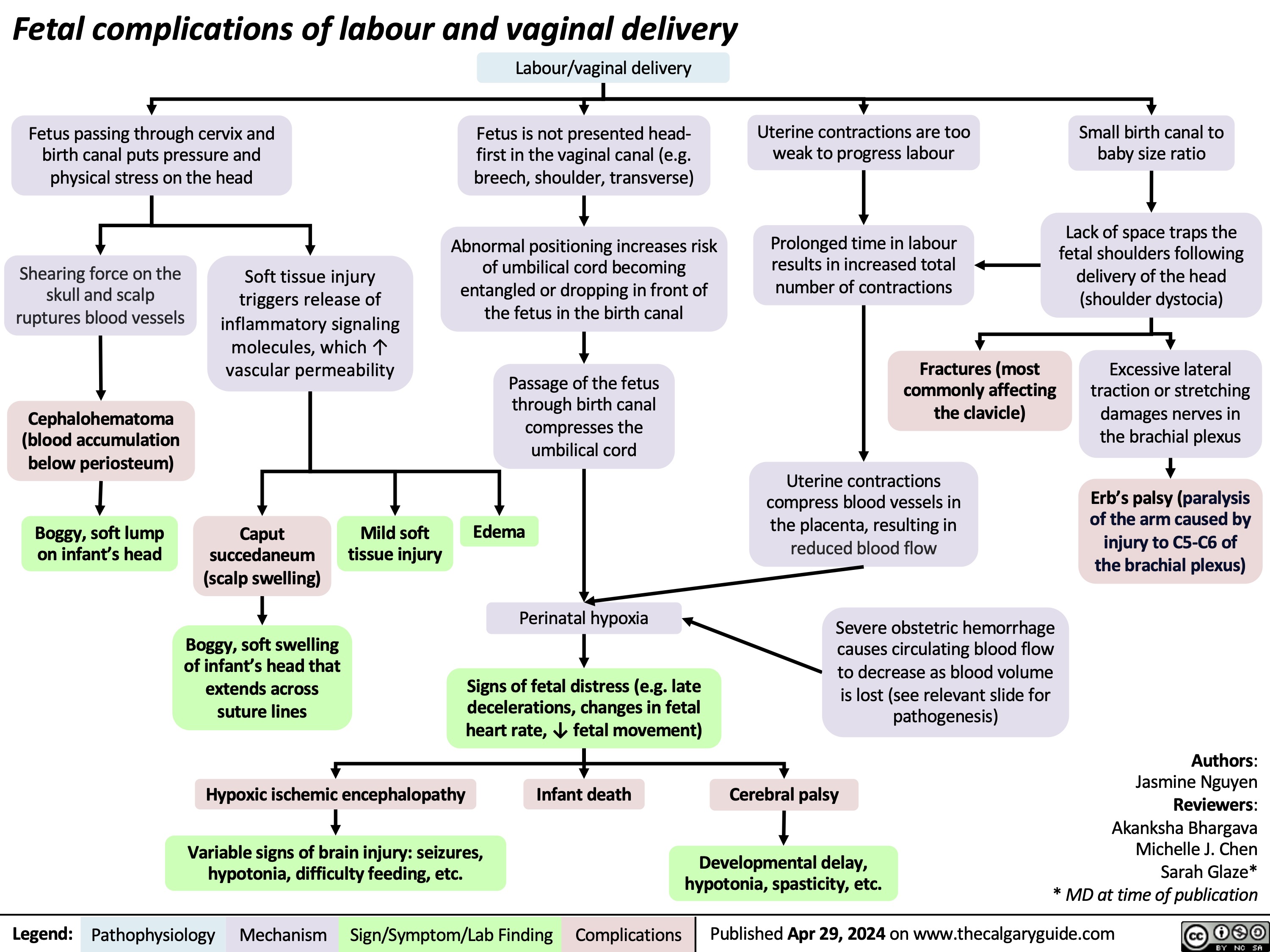 Fetal complications of labour and vaginal delivery
       Fetus passing through cervix and birth canal puts pressure and physical stress on the head
Labour/vaginal delivery
Fetus is not presented head- first in the vaginal canal (e.g. breech, shoulder, transverse)
Abnormal positioning increases risk of umbilical cord becoming entangled or dropping in front of the fetus in the birth canal
Passage of the fetus through birth canal compresses the umbilical cord
Edema
Perinatal hypoxia
Signs of fetal distress (e.g. late decelerations, changes in fetal heart rate, ↓ fetal movement)
Infant death
Uterine contractions are too weak to progress labour
Prolonged time in labour results in increased total number of contractions
Fractures (most commonly affecting the clavicle)
Uterine contractions compress blood vessels in the placenta, resulting in reduced blood flow
Severe obstetric hemorrhage causes circulating blood flow to decrease as blood volume is lost (see relevant slide for pathogenesis)
Small birth canal to baby size ratio
Lack of space traps the fetal shoulders following delivery of the head (shoulder dystocia)
Excessive lateral traction or stretching damages nerves in the brachial plexus
Erb’s palsy (paralysis of the arm caused by injury to C5-C6 of the brachial plexus)
        Shearing force on the skull and scalp ruptures blood vessels
Cephalohematoma (blood accumulation below periosteum)
Boggy, soft lump on infant’s head
Soft tissue injury triggers release of inflammatory signaling molecules, which ↑ vascular permeability
               Caput succedaneum (scalp swelling)
Boggy, soft swelling of infant’s head that extends across suture lines
Mild soft tissue injury
         Hypoxic ischemic encephalopathy
Variable signs of brain injury: seizures, hypotonia, difficulty feeding, etc.
Cerebral palsy
Developmental delay, hypotonia, spasticity, etc.
Authors: Jasmine Nguyen Reviewers: Akanksha Bhargava Michelle J. Chen Sarah Glaze* * MD at time of publication
   Legend:
 Pathophysiology
 Mechanism
Sign/Symptom/Lab Finding
 Complications
 Published Apr 29, 2024 on www.thecalgaryguide.com
  