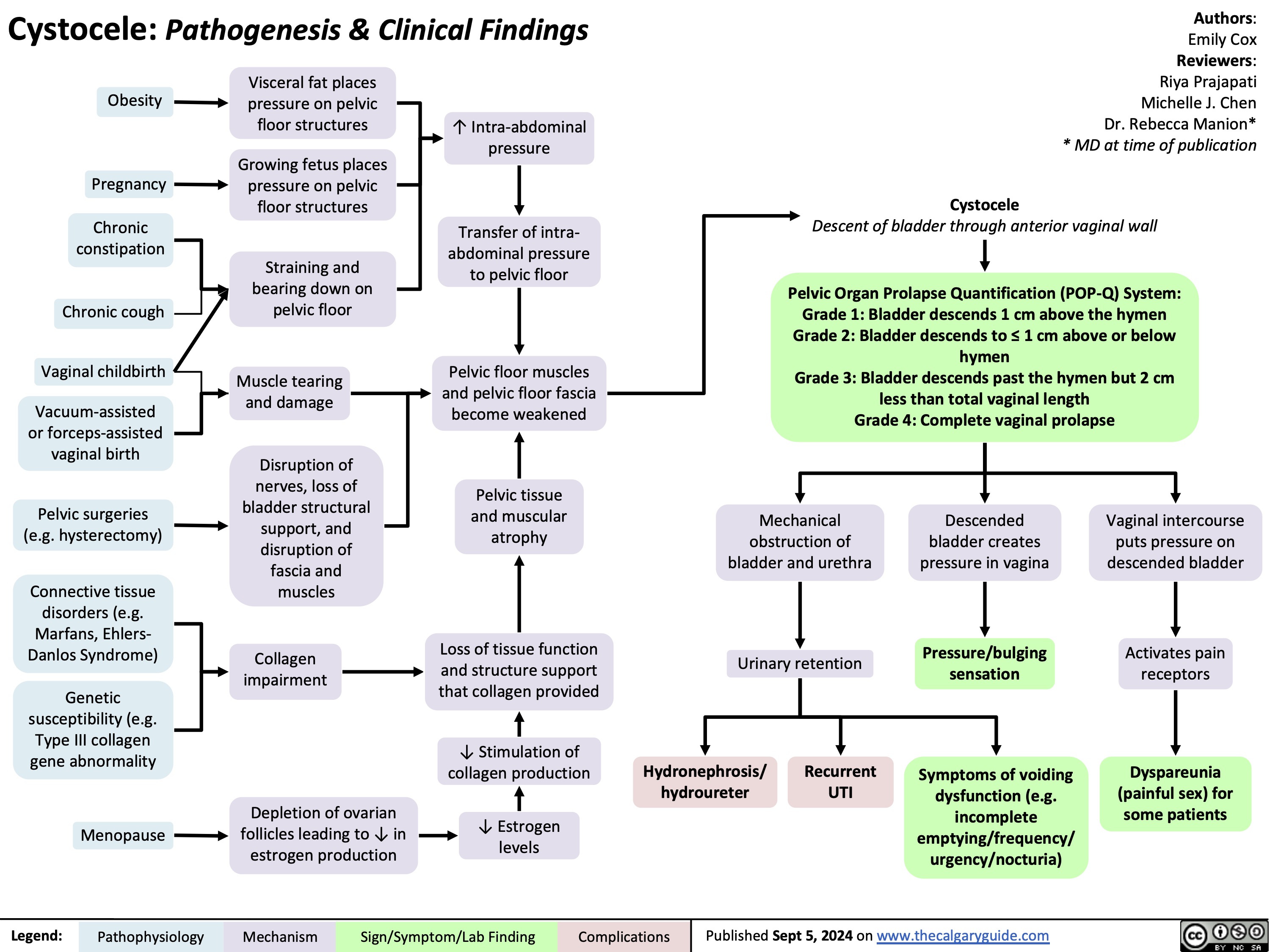  Cystocele: Pathogenesis & Clinical Findings
Authors: Emily Cox Reviewers: Riya Prajapati Michelle J. Chen Dr. Rebecca Manion* * MD at time of publication
  Obesity
Pregnancy
Chronic constipation
Chronic cough
Vaginal childbirth
Vacuum-assisted or forceps-assisted vaginal birth
Pelvic surgeries (e.g. hysterectomy)
Connective tissue disorders (e.g. Marfans, Ehlers- Danlos Syndrome)
Genetic susceptibility (e.g. Type III collagen gene abnormality
Menopause
Visceral fat places pressure on pelvic floor structures
Growing fetus places pressure on pelvic floor structures
Straining and bearing down on pelvic floor
Muscle tearing and damage
Disruption of nerves, loss of bladder structural support, and disruption of fascia and muscles
Collagen impairment
Depletion of ovarian follicles leading to ↓ in estrogen production
↑ Intra-abdominal pressure
Transfer of intra- abdominal pressure to pelvic floor
Pelvic floor muscles and pelvic floor fascia become weakened
Pelvic tissue and muscular atrophy
Loss of tissue function and structure support that collagen provided
↓ Stimulation of collagen production
↓ Estrogen levels
Pelvic Organ Prolapse Quantification (POP-Q) System: Grade 1: Bladder descends 1 cm above the hymen Grade 2: Bladder descends to ≤ 1 cm above or below hymen
Grade 3: Bladder descends past the hymen but 2 cm less than total vaginal length
Grade 4: Complete vaginal prolapse
                             Mechanical obstruction of bladder and urethra
Urinary retention
Descended bladder creates pressure in vagina
Pressure/bulging sensation
Symptoms of voiding dysfunction (e.g. incomplete emptying/frequency/ urgency/nocturia)
Vaginal intercourse puts pressure on descended bladder
Activates pain receptors
Dyspareunia (painful sex) for some patients
Cystocele
Descent of bladder through anterior vaginal wall
                    Hydronephrosis/ hydroureter
Recurrent UTI
       Legend:
Pathophysiology
Mechanism
Sign/Symptom/Lab Finding
Complications
Published Sept 5, 2024 on www.thecalgaryguide.com
    