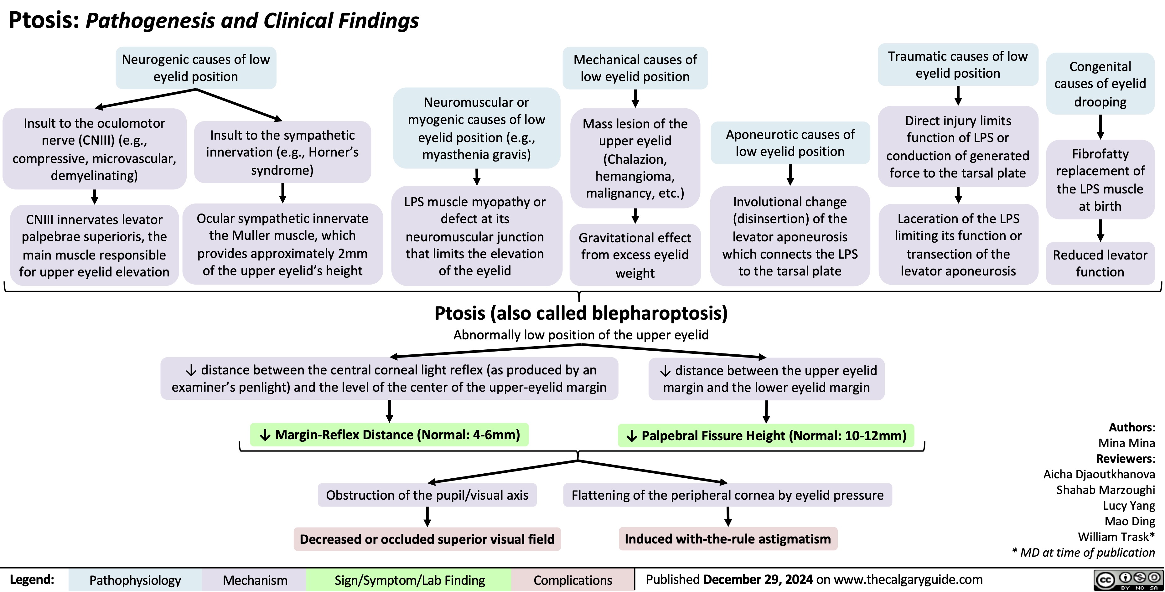 Ptosis: Pathogenesis and Clinical Findings Neurogenic causes of low
Mechanical causes of low eyelid position
Mass lesion of the upper eyelid (Chalazion, hemangioma, malignancy, etc.)
Gravitational effect from excess eyelid weight
Traumatic causes of low eyelid position
Direct injury limits function of LPS or conduction of generated force to the tarsal plate
Laceration of the LPS limiting its function or transection of the levator aponeurosis
Congenital causes of eyelid drooping
Fibrofatty replacement of the LPS muscle at birth
Reduced levator function
    eyelid position
     Insult to the oculomotor nerve (CNIII) (e.g., compressive, microvascular, demyelinating)
CNIII innervates levator palpebrae superioris, the main muscle responsible for upper eyelid elevation
Insult to the sympathetic innervation (e.g., Horner’s syndrome)
Ocular sympathetic innervate the Muller muscle, which provides approximately 2mm of the upper eyelid’s height
Neuromuscular or myogenic causes of low eyelid position (e.g., myasthenia gravis)
LPS muscle myopathy or defect at its neuromuscular junction that limits the elevation of the eyelid
Aponeurotic causes of low eyelid position
Involutional change (disinsertion) of the levator aponeurosis which connects the LPS to the tarsal plate
           Ptosis (also called blepharoptosis)
Abnormally low position of the upper eyelid
   ↓ distance between the central corneal light reflex (as produced by an examiner’s penlight) and the level of the center of the upper-eyelid margin
↓ Margin-Reflex Distance (Normal: 4-6mm)
Obstruction of the pupil/visual axis
Decreased or occluded superior visual field
↓ distance between the upper eyelid margin and the lower eyelid margin
↓ Palpebral Fissure Height (Normal: 10-12mm)
Flattening of the peripheral cornea by eyelid pressure
Induced with-the-rule astigmatism
Authors: Mina Mina Reviewers: Aicha Djaoutkhanova Shahab Marzoughi Lucy Yang Mao Ding William Trask* * MD at time of publication
         Legend:
 Pathophysiology
Mechanism
Sign/Symptom/Lab Finding
 Complications
 Published December 29, 2024 on www.thecalgaryguide.com
   