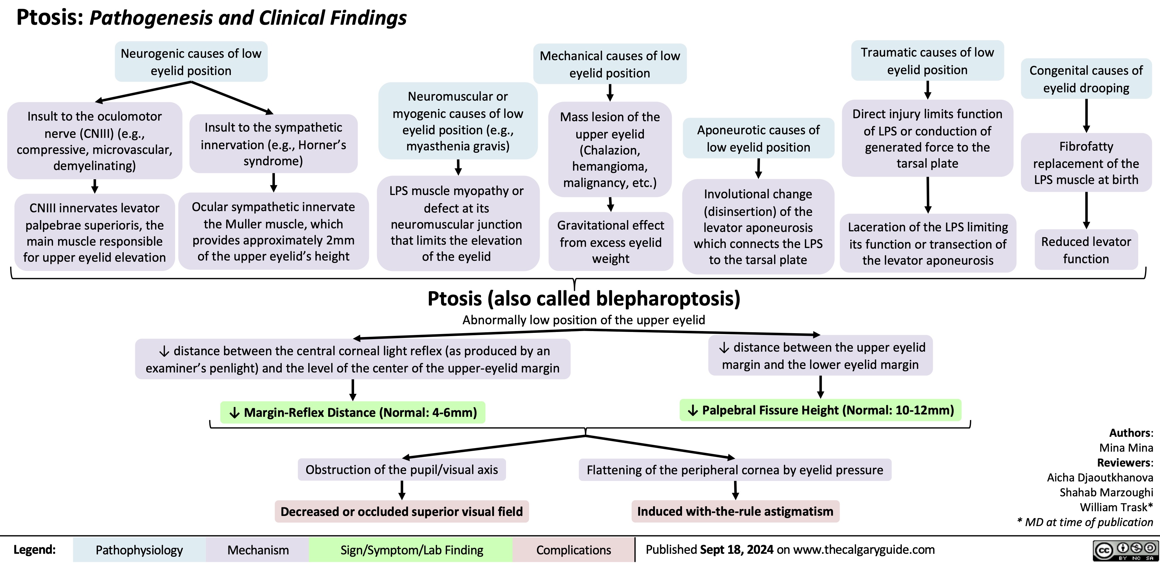 Ptosis: Pathogenesis and Clinical Findings Neurogenic causes of low
Mechanical causes of low eyelid position
Mass lesion of the upper eyelid (Chalazion, hemangioma, malignancy, etc.)
Gravitational effect from excess eyelid weight
Traumatic causes of low eyelid position
Direct injury limits function of LPS or conduction of generated force to the tarsal plate
Laceration of the LPS limiting its function or transection of the levator aponeurosis
    eyelid position
Congenital causes of eyelid drooping
Fibrofatty replacement of the LPS muscle at birth
Reduced levator function
      Insult to the oculomotor nerve (CNIII) (e.g., compressive, microvascular, demyelinating)
CNIII innervates levator palpebrae superioris, the main muscle responsible for upper eyelid elevation
Insult to the sympathetic innervation (e.g., Horner’s syndrome)
Ocular sympathetic innervate the Muller muscle, which provides approximately 2mm of the upper eyelid’s height
Neuromuscular or myogenic causes of low eyelid position (e.g., myasthenia gravis)
LPS muscle myopathy or defect at its neuromuscular junction that limits the elevation of the eyelid
Aponeurotic causes of low eyelid position
Involutional change (disinsertion) of the levator aponeurosis which connects the LPS to the tarsal plate
             Ptosis (also called blepharoptosis)
Abnormally low position of the upper eyelid
   ↓ distance between the central corneal light reflex (as produced by an examiner’s penlight) and the level of the center of the upper-eyelid margin
↓ Margin-Reflex Distance (Normal: 4-6mm)
Obstruction of the pupil/visual axis
Decreased or occluded superior visual field
↓ distance between the upper eyelid margin and the lower eyelid margin
↓ Palpebral Fissure Height (Normal: 10-12mm)
Flattening of the peripheral cornea by eyelid pressure
Induced with-the-rule astigmatism
Authors: Mina Mina Reviewers: Aicha Djaoutkhanova Shahab Marzoughi William Trask* * MD at time of publication
         Legend:
 Pathophysiology
 Mechanism
Sign/Symptom/Lab Finding
 Complications
 Published Sept 18, 2024 on www.thecalgaryguide.com
  