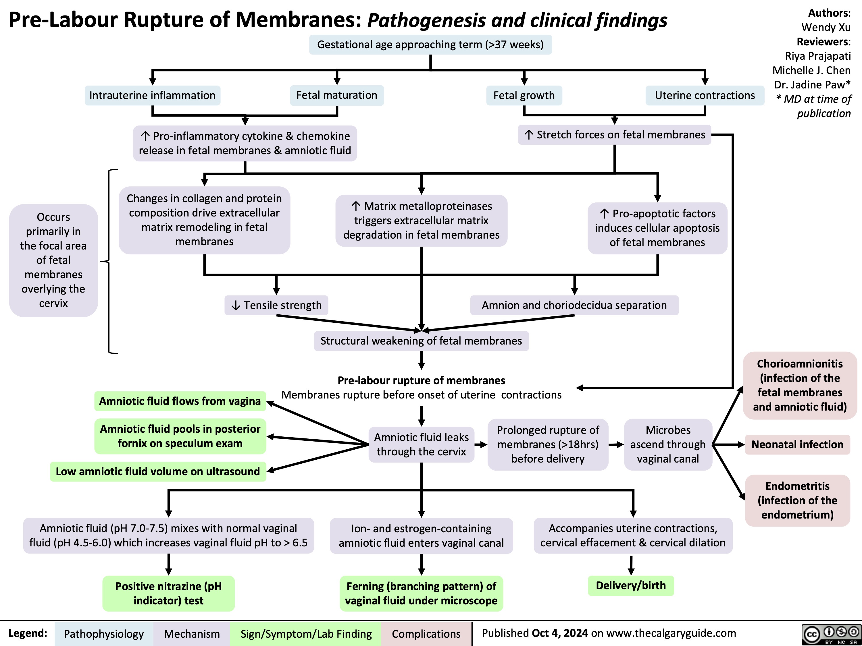 Pre-Labour Rupture of Membranes: Pathogenesis and clinical findings Gestational age approaching term (>37 weeks)
Authors: Wendy Xu Reviewers: Riya Prajapati Michelle J. Chen Dr. Jadine Paw* * MD at time of publication
      Intrauterine inflammation
Fetal maturation
Fetal growth
Uterine contractions
    ↑ Pro-inflammatory cytokine & chemokine release in fetal membranes & amniotic fluid
↑ Stretch forces on fetal membranes
↑ Pro-apoptotic factors induces cellular apoptosis of fetal membranes
    Changes in collagen and protein composition drive extracellular matrix remodeling in fetal membranes
↓ Tensile strength
Structural weakening of fetal membranes
   Occurs primarily in the focal area of fetal membranes overlying the cervix
↑ Matrix metalloproteinases triggers extracellular matrix degradation in fetal membranes
    Amnion and choriodecidua separation
    Amniotic fluid flows from vagina
Amniotic fluid pools in posterior fornix on speculum exam
Pre-labour rupture of membranes
Membranes rupture before onset of uterine contractions
Chorioamnionitis (infection of the fetal membranes and amniotic fluid)
Neonatal infection
Endometritis (infection of the endometrium)
     Amniotic fluid leaks through the cervix
Prolonged rupture of membranes (>18hrs) before delivery
Microbes ascend through vaginal canal
  Low amniotic fluid volume on ultrasound
Amniotic fluid (pH 7.0-7.5) mixes with normal vaginal fluid (pH 4.5-6.0) which increases vaginal fluid pH to > 6.5
Positive nitrazine (pH indicator) test
Ion- and estrogen-containing amniotic fluid enters vaginal canal
Ferning (branching pattern) of vaginal fluid under microscope
Accompanies uterine contractions, cervical effacement & cervical dilation
Delivery/birth
        Legend:
 Pathophysiology
 Mechanism
Sign/Symptom/Lab Finding
 Complications
 Published Oct 4, 2024 on www.thecalgaryguide.com
  