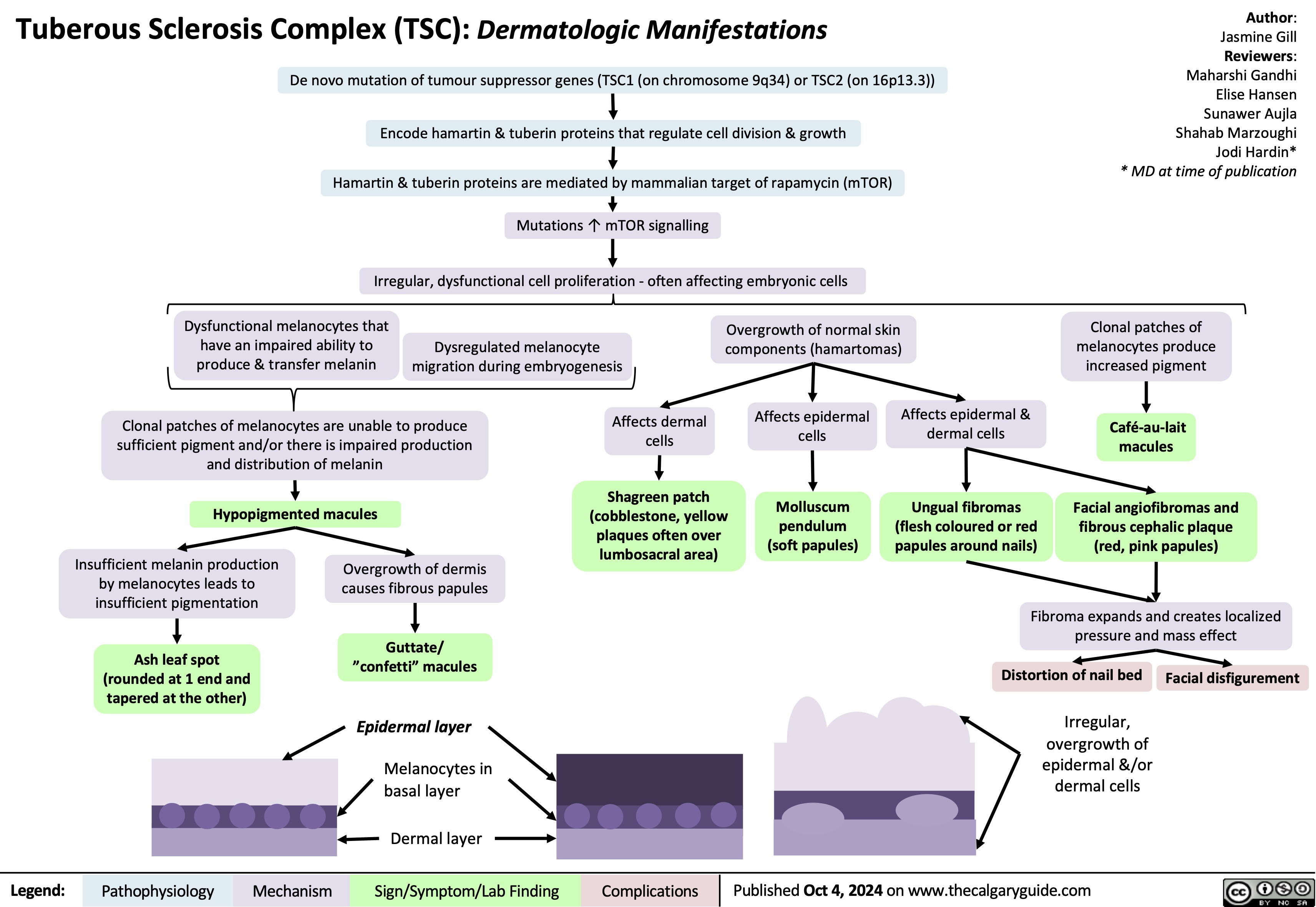 Tuberous Sclerosis Complex (TSC): Dermatologic Manifestations
De novo mutation of tumour suppressor genes (TSC1 (on chromosome 9q34) or TSC2 (on 16p13.3))
Encode hamartin & tuberin proteins that regulate cell division & growth
Hamartin & tuberin proteins are mediated by mammalian target of rapamycin (mTOR) Mutations ↑ mTOR signalling
Irregular, dysfunctional cell proliferation - often affecting embryonic cells
Author: Jasmine Gill Reviewers: Maharshi Gandhi Elise Hansen Sunawer Aujla Shahab Marzoughi Jodi Hardin* * MD at time of publication
         Dysfunctional melanocytes that have an impaired ability to produce & transfer melanin
Dysregulated melanocyte migration during embryogenesis
Overgrowth of normal skin components (hamartomas)
Clonal patches of melanocytes produce increased pigment
Café-au-lait macules
Facial angiofibromas and fibrous cephalic plaque (red, pink papules)
         Clonal patches of melanocytes are unable to produce sufficient pigment and/or there is impaired production and distribution of melanin
Hypopigmented macules
Affects dermal cells
Shagreen patch (cobblestone, yellow plaques often over lumbosacral area)
Affects epidermal cells
Molluscum pendulum (soft papules)
Affects epidermal & dermal cells
Ungual fibromas (flesh coloured or red papules around nails)
        Insufficient melanin production by melanocytes leads to insufficient pigmentation
Ash leaf spot (rounded at 1 end and tapered at the other)
Overgrowth of dermis causes fibrous papules
Guttate/ ”confetti” macules
Epidermal layer
Melanocytes in basal layer
Fibroma expands and creates localized pressure and mass effect
       Distortion of nail bed
Irregular, overgrowth of epidermal &/or dermal cells
Facial disfigurement
            Dermal layer
  Legend:
 Pathophysiology
 Mechanism
Sign/Symptom/Lab Finding
 Complications
 Published Oct 4, 2024 on www.thecalgaryguide.com
  