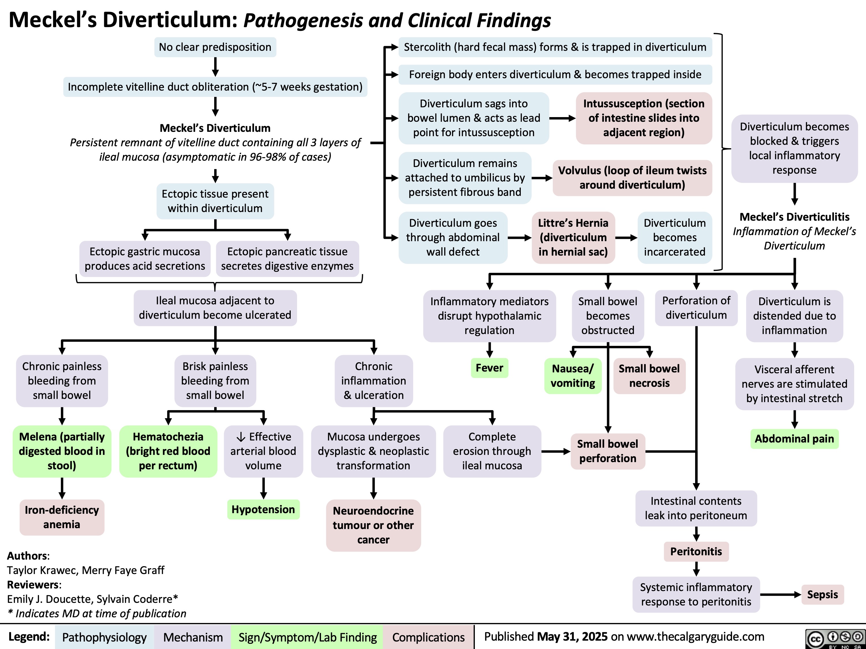 Meckel’s Diverticulum: Pathogenesis and Clinical Findings
No clear predisposition
Stercolith (hard fecal mass) forms & is trapped in diverticulum
Foreign body enters diverticulum & becomes trapped inside
Incomplete vitelline duct obliteration (~5-7 weeks gestation)
Diverticulum sags into
Intussusception (section
bowel lumen & acts as lead
of intestine slides into
Meckel’s Diverticulum
point for intussusception
adjacent region)
Persistent remnant of vitelline duct containing all 3 layers of
ileal mucosa (asymptomatic in 96-98% of cases)
Diverticulum remains
attached to umbilicus by
persistent fibrous band
Volvulus (loop of ileum twists
around diverticulum)
Ectopic tissue present
within diverticulum
Diverticulum goes
through abdominal
wall defect
Littre’s Hernia
(diverticulum
in hernial sac)
Diverticulum
becomes
incarcerated
Ectopic gastric mucosa
produces acid secretions
Ectopic pancreatic tissue
secretes digestive enzymes
Ileal mucosa adjacent to
diverticulum become ulcerated
Inflammatory mediators
disrupt hypothalamic
regulation
Small bowel
becomes
obstructed
Perforation of
diverticulum
Brisk painless
bleeding from
small bowel
Chronic
inflammation
& ulceration
Fever
Nausea/
vomiting
Small bowel
necrosis
Hematochezia
(bright red blood
per rectum)
↓ Effective
arterial blood
volume
Mucosa undergoes
dysplastic & neoplastic
transformation
Complete
erosion through
ileal mucosa
Small bowel
perforation
Hypotension
Neuroendocrine
tumour or other
cancer
Diverticulum becomes
blocked & triggers
local inflammatory
response
Meckel’s Diverticulitis
Inflammation of Meckel’s
Diverticulum
Diverticulum is
distended due to
inflammation
Visceral afferent
nerves are stimulated
by intestinal stretch
Abdominal pain
Chronic painless
bleeding from
small bowel
Melena (partially
digested blood in
stool)
Iron-deficiency
anemia
Authors:
Taylor Krawec, Merry Faye Graff
Reviewers:
Emily J. Doucette, Sylvain Coderre*
* Indicates MD at time of publication
Legend: Pathophysiology Mechanism
Sign/Symptom/Lab Finding Complications
Intestinal contents
leak into peritoneum
Peritonitis
Systemic inflammatory
response to peritonitis
Published May 31, 2025 on www.thecalgaryguide.com
Sepsis
