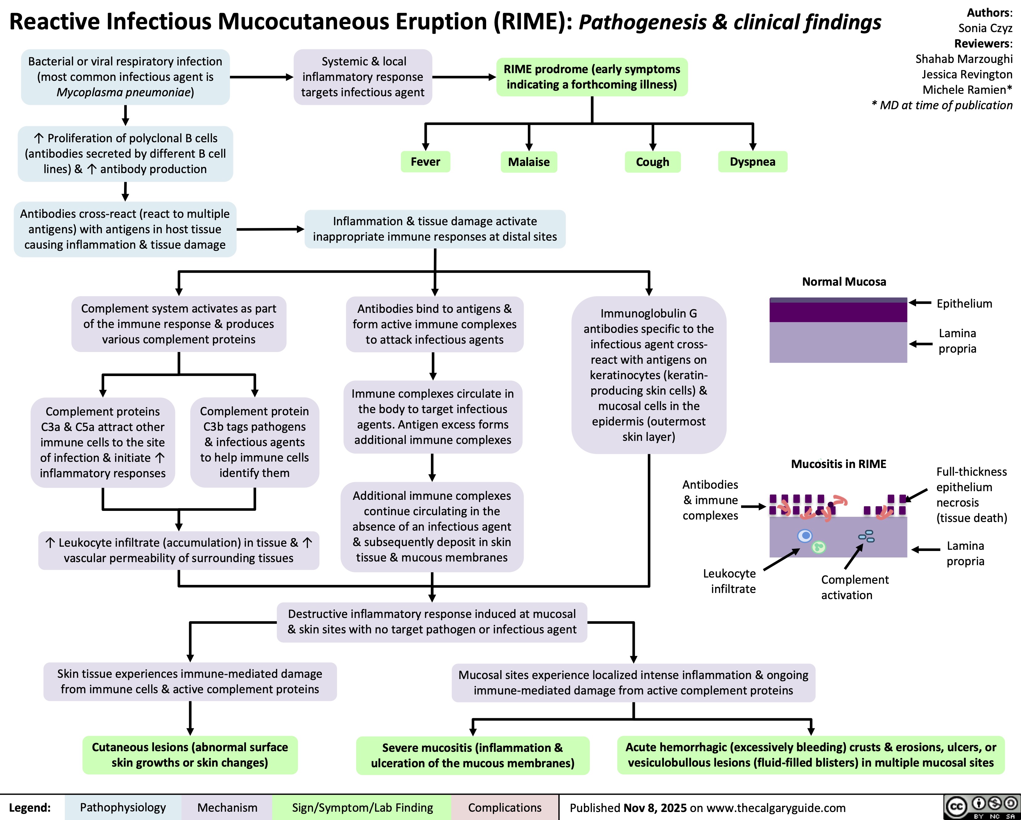 Reactive Infectious Mucocutaneous Eruption (RIME): Pathogenesis & clinical findings
Bacterial or viral respiratory infection
(most common infectious agent is
Mycoplasma pneumoniae)
↑ Proliferation of polyclonal B cells
(antibodies secreted by different B cell
lines) & ↑ antibody production
Antibodies cross-react (react to multiple
antigens) with antigens in host tissue
causing inflammation & tissue damage
Systemic & local
inflammatory response
targets infectious agent
RIME prodrome (early symptoms
indicating a forthcoming illness)
Fever
Malaise
Cough Dyspnea
Inflammation & tissue damage activate
inappropriate immune responses at distal sites
Authors:
Sonia Czyz
Reviewers:
Shahab Marzoughi
Jessica Revington
Michele Ramien*
* MD at time of publication
Normal Mucosa
Complement system activates as part
of the immune response & produces
various complement proteins
Epithelium
Lamina
propria
Complement proteins
C3a & C5a attract other
immune cells to the site
of infection & initiate ↑
inflammatory responses
Complement protein
C3b tags pathogens
& infectious agents
to help immune cells
identify them
↑ Leukocyte infiltrate (accumulation) in tissue & ↑
vascular permeability of surrounding tissues
Skin tissue experiences immune-mediated damage
from immune cells & active complement proteins
Cutaneous lesions (abnormal surface
skin growths or skin changes)
Mucositis in RIME
Legend: Pathophysiology Mechanism
Antibodies bind to antigens &
form active immune complexes
to attack infectious agents
Immune complexes circulate in
the body to target infectious
agents. Antigen excess forms
additional immune complexes
Immunoglobulin G
antibodies specific to the
infectious agent cross-
react with antigens on
keratinocytes (keratin-
producing skin cells) &
mucosal cells in the
epidermis (outermost
skin layer)
Additional immune complexes
continue circulating in the
absence of an infectious agent
& subsequently deposit in skin
tissue & mucous membranes
Antibodies
& immune
complexes
Leukocyte
infiltrate
Destructive inflammatory response induced at mucosal
& skin sites with no target pathogen or infectious agent
Complement
activation
Mucosal sites experience localized intense inflammation & ongoing
immune-mediated damage from active complement proteins
Severe mucositis (inflammation &
ulceration of the mucous membranes)
Acute hemorrhagic (excessively bleeding) crusts & erosions, ulcers, or
vesiculobullous lesions (fluid-filled blisters) in multiple mucosal sites
Published Nov 8, 2025 on www.thecalgaryguide.com
Full-thickness
epithelium
necrosis
(tissue death)
Lamina
propria
Sign/Symptom/Lab Finding Complications
Mucositis in RIME
Reactive Infectious Mucocutaneous Eruption (RIME): Pathogenesis and clinical findings
Normal Mucosa
Epithelium
Bacterial or viral respiratory infection; most
common infection is Mycoplasma
pneumoniae
Systemic and local
inflammatory response
towards invading microbe
Lamina
propria
Polyclonal B cell proliferation
and antibody production
Full-thickness
epithelium necrosis
Prodrome: cough, dyspnea, malaise, fever ~1
week prior to mucocutaneous eruption
The antibodies cross-react with host tissue
causing inflammation and tissue damage
Lamina
propria
Authors:
Sonia Czyz
Reviewers:
Shahab Marzoughi
* MD at time of publication
Inappropriate immune
responses at distal sites
Molecular
mimicry
Immune complex
activation
Complement
activation
I would remove all of this
Immunoglobulin G
antibodies specific for
invading microbe cross-
react with antigens on
keratinocytes and
mucosal cells in the
epidermis
Circulating immune
complexes form in
antigen excess
C3a, C5a, and C3b
produced
Deposition in
skin and mucous
membrane
↑ Leukocyte
infiltrate and
vascular
permeability
Severe mucositis
(inflammation and
ulceration of the
mucous
membranes
Destructive
inflammatory
response at mucosal
and skin sites
Antibodies
& immune
complexes
Leukocyte
infiltrate
Complement
activation
Acute occurrence of hemorrhagic
crusts and erosions, ulcers, or
vesiculobullous lesions in 2 or
more mucosal sites
Localized inflammation and
immune response activate
complement system which
damage mucosal tissues
Immune
response leads
to painful, red
nodules
typically on
the shins
Triggering localized, intense
inflammation and immune-
mediated damage in these
specific mucosal sites.
Legend: Widespread
systemic
immune
response
Erythema
nodosum
Urticaria
Immune response
results in hives or
itchy welts on the
skin.
Pathophysiology Mechanism
Sign/Symptom/Lab Finding Complications
Cutaneous
lesions
Published MONTH, DAY, YEAR on www.thecalgaryguide.com